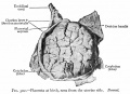 Placenta maternal side (term)