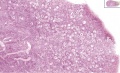 Histological image of primordial follicles in infant ovary Existing website image.