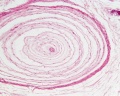 Histology of a Pacinian Corpuscle-Notice onion like structure