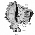 Fig. 275. From a reconstruction of the anlagen of the liver and pancreas and the stomach of a human embryo of 8 mm