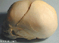 Skull lateral view ( suture, mandible)