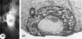 26-27 surface and mid-cross section view 12-day ovum