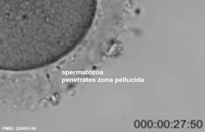 Human spermatozoa penetrating zona pellucida during fertilisation