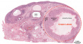 Ovary - corpus luteum