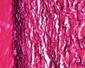 Artery elastin detail