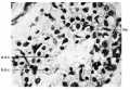 Fig. 14. alveolar cells Full term embryo