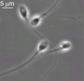 Human spermatozoa