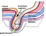 processus vaginalis