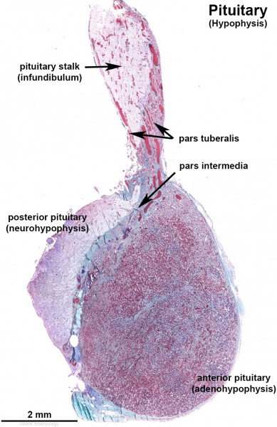 File:Pituitary histology 011.jpg