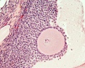 antral follicle